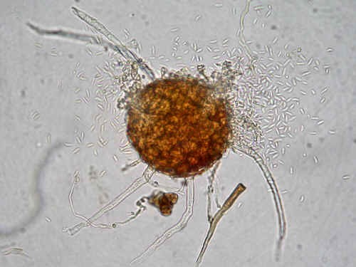 Cleistotecio di oidio parassitizzato da Ampelomyces quisqualis