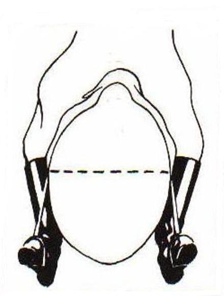 Schema del trotto