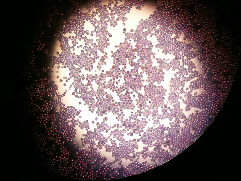 Saccharomyces cerevisiae